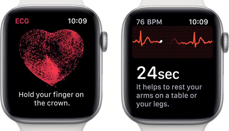 AppleWatch ECG Features