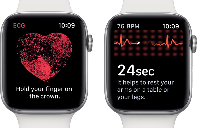 AppleWatch ECG Features